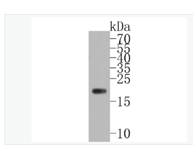 Anti-Ferritin Heavy Chain antibody-铁蛋白重组兔单克隆抗体