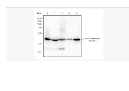 Anti-ADRB2 antibody-肾上腺素能受体β2重组兔单克隆抗体