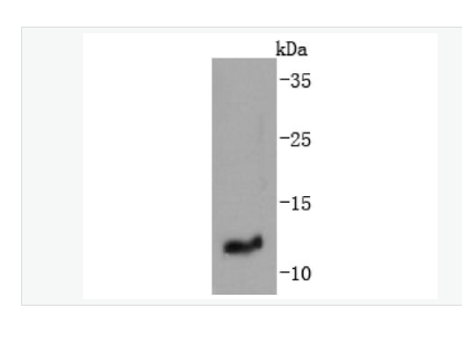 Anti-IGF2 antibody -胰岛素样生长因子-II重组兔单克隆抗体