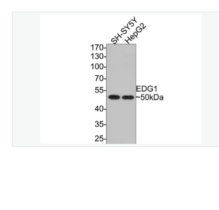 Anti-EDG1 antibody-内皮细胞分化鞘脂G蛋白偶联受体1重组兔单克隆抗体