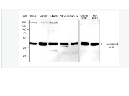 Anti-Pan Actin antibody -泛肌动蛋白重组兔单抗