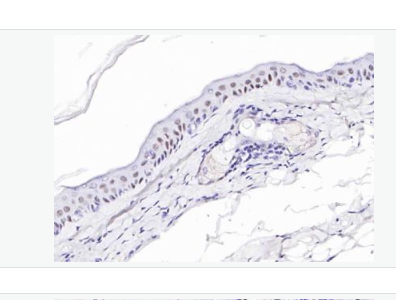 Anti-p63 antibody -肿瘤抑制基因p63α单克隆抗体