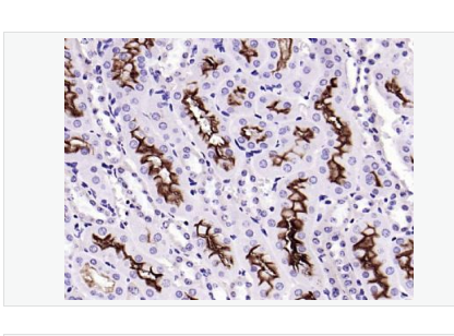 Anti-ACE2 antibody-血管紧张素转换酶2抗体