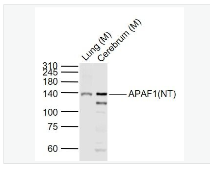 Anti-APAF1(NT) antibody-凋亡蛋白活性因子-1抗体（N端）