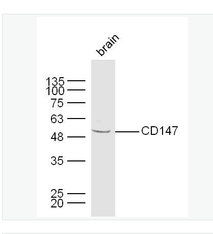 Anti-CD147 antibody-细胞外基质金属蛋白酶诱导因子抗体