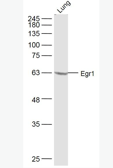 Anti-Egr1 antibody-早期生长应答蛋白1抗体