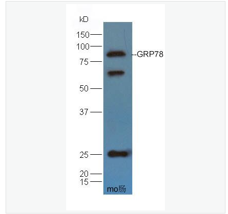 Anti-GRP78 antibody-葡萄糖调节蛋白78/热休克蛋白70蛋白5抗体