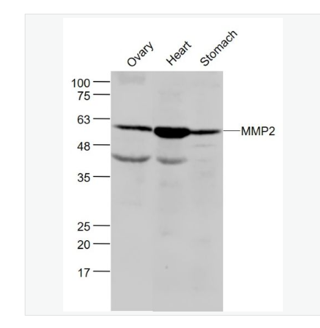 Anti-MMP2 antibody-基质金属蛋白酶2抗体