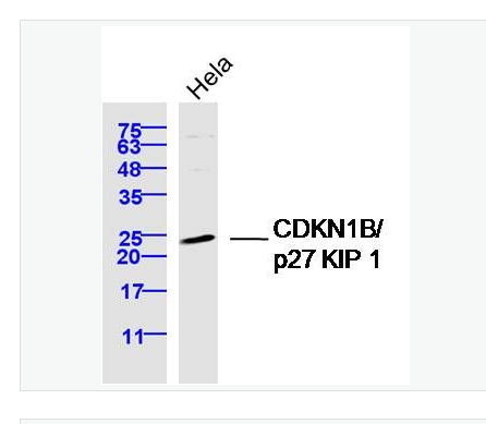 Anti-CDKN1B/p27 KIP 1 antibody-P27抗体/周期素依赖激酶抑制剂
