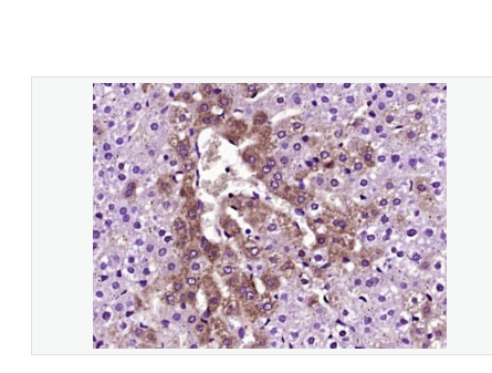 Anti-TTR/Prealbumin antibody-转甲状腺素蛋白/前白蛋白抗体