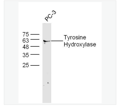 Anti-Tyrosine Hydroxylase antibody-酪氨酸羟化酶抗体