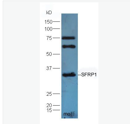 Anti-SFRP1 antibody-分泌型卷曲相关蛋白1抗体