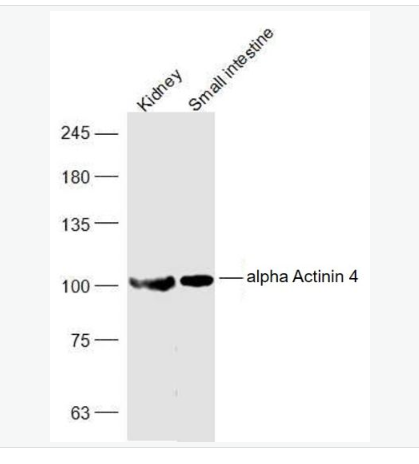 Anti-alpha Actinin 4 antibody-α-辅肌动蛋白4抗体