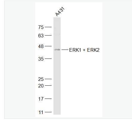Anti-ERK1 + ERK2 antibody-丝裂原活化蛋白激酶1/2抗体