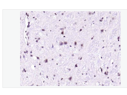 Anti-phospho-IRS1 antibody-磷酸化胰岛素受体底物-1抗体