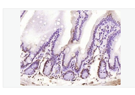 Anti-phospho-PKC delta (Tyr311) antibody-磷酸化蛋白激酶C亚性D型抗体