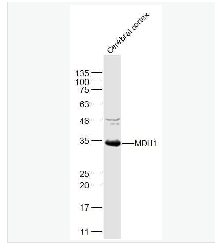 Anti-MDH1 antibody-可溶性苹果酸脱氢酶抗体