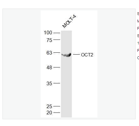 Anti-OCT2 antibody -胚胎干细胞关键蛋白2抗体
