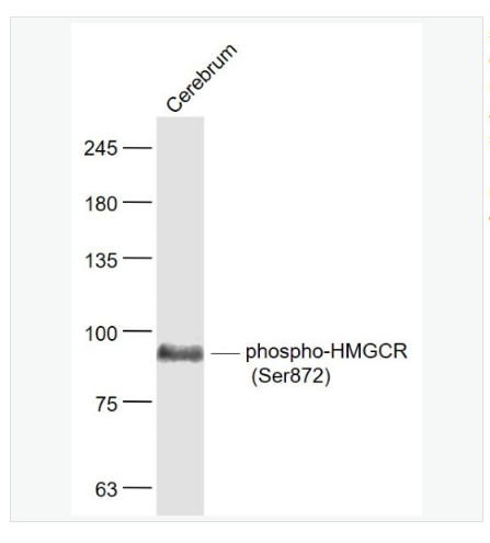 Anti-phospho-HMGCR antibody -磷酸化三羟基三甲基辅酶A还原酶抗体