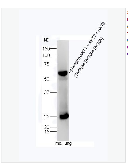 Anti-phospho-AKT1 + AKT2 + AKT3antibody -磷酸化蛋白激酶B抗体