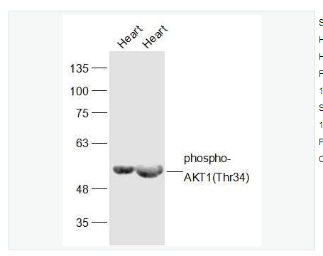 Anti-phospho-AKT1 antibody -磷酸化蛋白激酶B抗体