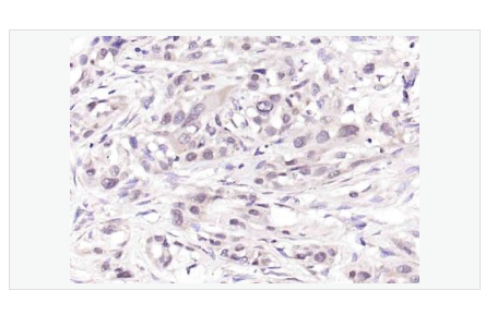 Anti-phospho-CDKN1A/p21antibody -磷酸化p21蛋白抗体