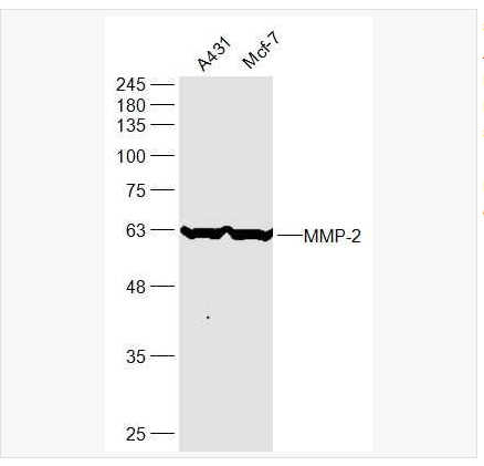 Anti-MMP-2 antibody -基质金属蛋白酶2抗体