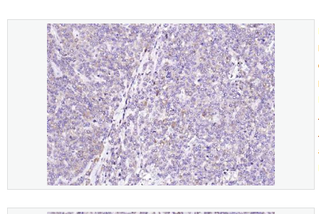 Anti-Sclerostin  antibody -骨形态发生抑制蛋白SOST抗体