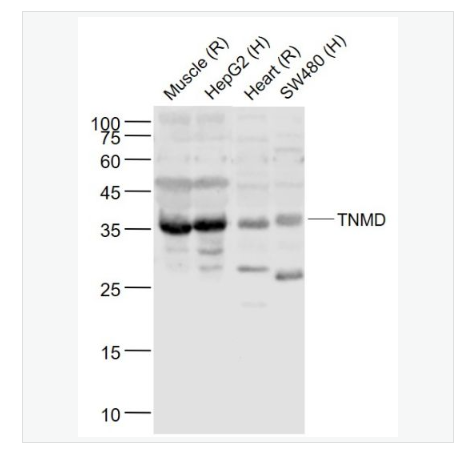 Anti-TNMD  antibody -腱调蛋白/软骨调节素样1蛋白抗体