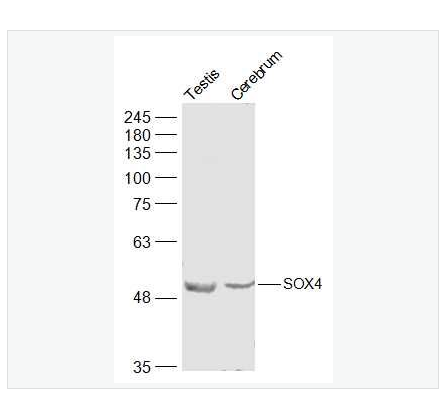 Anti-SOX4  antibody -核转录因子SOX4抗体
