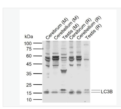 Anti-LC3B antibody-自噬微管相关蛋白轻链β3抗体