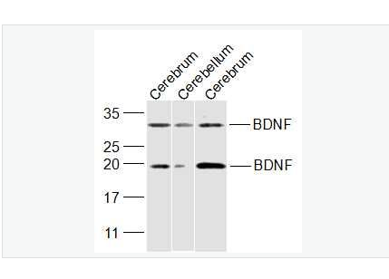 Anti-BDNF antibody-脑源神经营养因子抗体