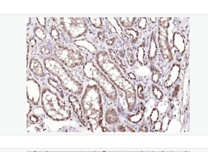 Anti-ADRM1 antibody-粘附调节分子1抗体