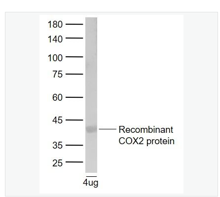 Anti-Cyclooxygenase 2 antibody-环氧合酶2/前列腺素内过氧化物合成酶2抗体