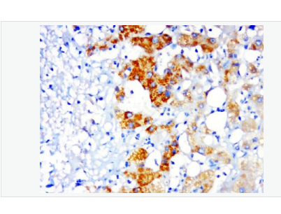 Anti-PSMD14 antibody-蛋白酶调解因子14抗体