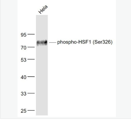 Anti-phospho-HSF1 (Ser326) antibody-磷酸化热休克因子1重组兔单克隆抗体