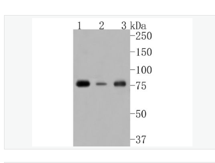 Anti-Phospho-PKC alpha (Thr638) antibody-磷酸化蛋白激酶C α/β2重组兔单克隆抗体