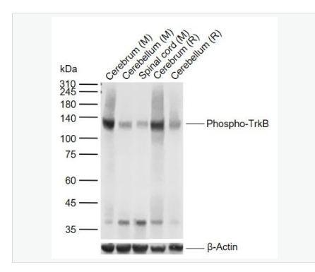 Anti-Phospho-TrkB (Tyr817) antibody-磷酸化酪氨酸激酶B(Tyr817)重组兔单克隆抗体