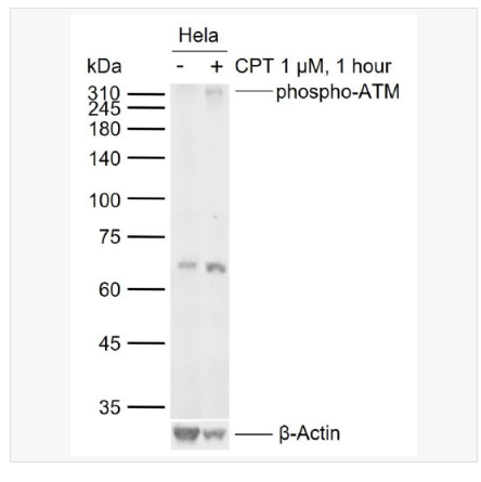 Anti-phospho-ATM (Ser1981) antibody-磷酸化ATM(Ser1981)重组兔单克隆抗体