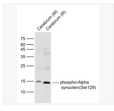 Anti-TFRC antibody-转铁蛋白受体（CD71）重组兔单克隆抗体