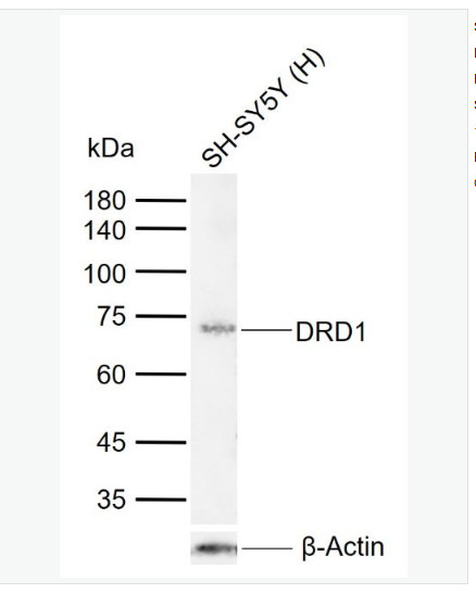 Anti-DRD1 antibody-多巴胺受体D1重组兔单克隆抗体