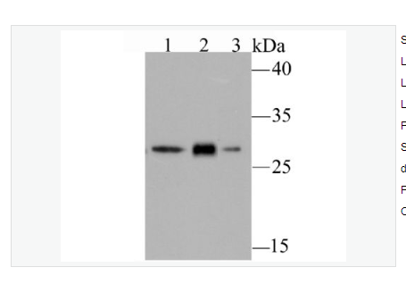 Anti-GCLM  antibody-GCLM重组兔单克隆抗体