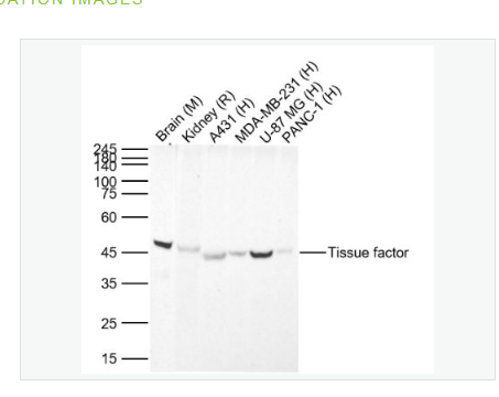 Anti-Tissue factor  antibody-组织因子（CD142）兔单克隆抗体