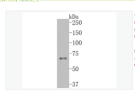 Anti-TCF7L2antibody-转录因子7类似物2重组兔单克隆抗体