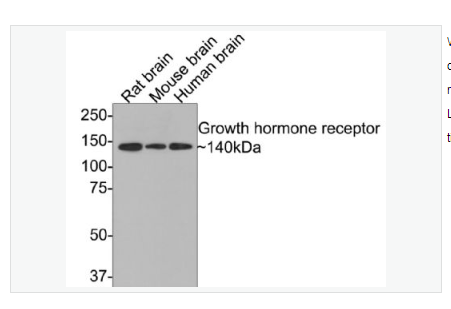 Anti-Growth hormone receptor  antibody-生长激素受体抗体