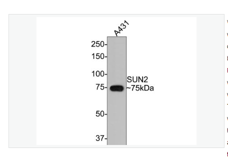 Anti-SUN2antibody-SUN2重组兔单克隆抗体