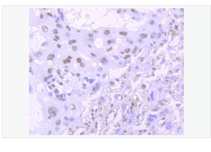 Anti-TARDBP antibody-Tar DNA 结合蛋白43抗体