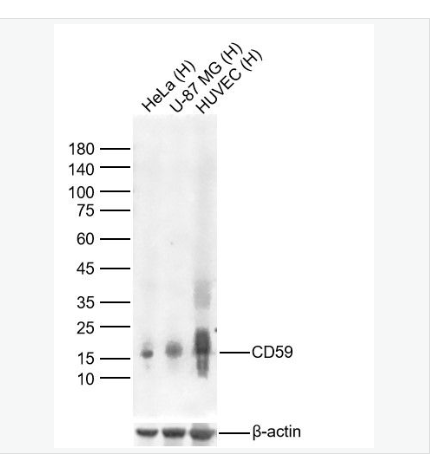 Anti-CD59antibody-CD59重组兔单克隆抗体