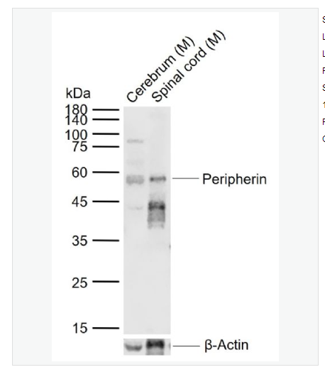 Anti-Peripherin antibody-外周蛋白抗体