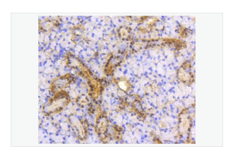 Anti-ACLY antibody-三磷酸腺柠檬酸裂解酶重组兔单克隆抗体